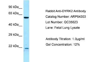 Western Blotting (WB) image for anti-Dual-Specificity tyrosine-(Y)-phosphorylation Regulated Kinase 2 (DYRK2) (C-Term) antibody (ABIN2789799)
