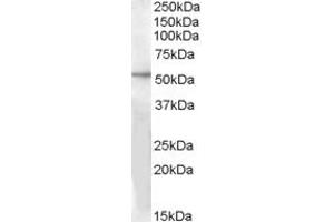 Western Blotting (WB) image for anti-G Protein-Coupled Receptor 142 (GPR142) (AA 298-310) antibody (ABIN343023)