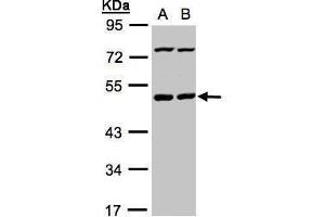 WB Image Sample(30 ug whole cell lysate) A:HeLa S3, B:Hep G2 , 10% SDS PAGE antibody diluted at 1:1000 (PSKH1 antibody)