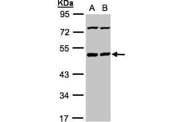PSKH1 anticorps