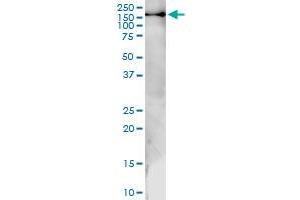 Immunoprecipitation of GTF2IRD1 transfected lysate using anti-GTF2IRD1 MaxPab rabbit polyclonal antibody and Protein A Magnetic Bead , and immunoblotted with GTF2IRD1 purified MaxPab mouse polyclonal antibody (B01P) . (GTF2IRD1 antibody  (AA 1-959))