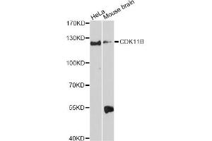 Western blot analysis of extracts of various cell lines, using CDK11B Antibody. (CDK11 antibody)