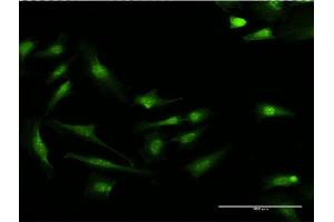 Immunofluorescence of monoclonal antibody to S100P on HeLa cell. (S100P antibody  (AA 1-95))