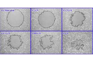 Inhibition of HeLa Cell Migration by Cytochalasin D. (Radius™ 24-Well Cell Migration Assay)