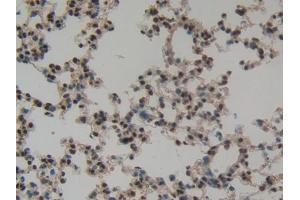 DAB staining on IHC-P; Samples: Mouse Lung Tissue (CASP14 antibody  (AA 17-248))