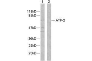 Western blot analysis of extracts from MDA-MB-435 cells, using ATF2 (Ab-112 or 94) Antibody. (ATF2 antibody  (AA 79-128))
