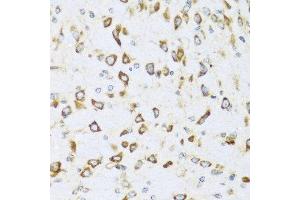 Immunohistochemistry of paraffin-embedded mouse brain using NRG4 antibody at dilution of 1:100 (40x lens). (Neuregulin 4 antibody)
