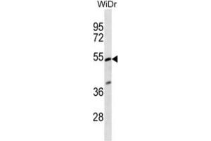 Western Blotting (WB) image for anti-Phosphatidylinositol Glycan Anchor Biosynthesis, Class V (PIGV) antibody (ABIN2997074) (PIGV antibody)