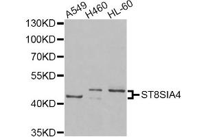 Western blot analysis of extracts of various cell lines, using ST8SIA4 Antibody. (ST8SIA4 antibody)