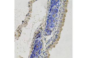Immunohistochemistry of paraffin-embedded mouse lung using INHBB antibody at dilution of 1:100 (x40 lens).
