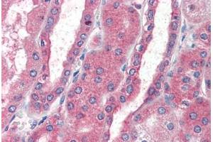 Human Kidney (formalin-fixed, paraffin-embedded) stained with CXCR4 antibody ABIN461996 at 5 ug/ml followed by biotinylated anti-goat IgG secondary antibody ABIN481715, alkaline phosphatase-streptavidin and chromogen. (CXCR4 antibody  (AA 14-40))