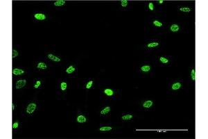Immunofluorescence of monoclonal antibody to PTPN22 on HeLa cell. (PTPN22 antibody  (AA 10-113))