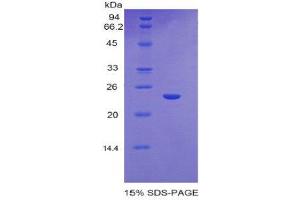 SDS-PAGE (SDS) image for Glutathione Synthetase (GSS) (AA 270-474) protein (His tag) (ABIN2121135)