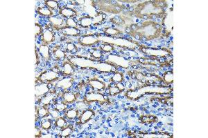 Immunohistochemistry (IHC) image for anti-Fission 1 (FIS1) antibody (ABIN7267209)