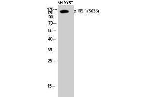 Western Blot analysis of SH-SY5Y cells using Phospho-IRS1 (Ser636) Polyclonal Antibody at dilution of 1:2000 (IRS1 antibody  (pSer636))