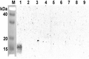 Western blot analysis using anti-ANGPTL5 (CCD) (human), pAb  at 1:2'000 dilution. (ANGPTL5 antibody  (Coiled coil domain))