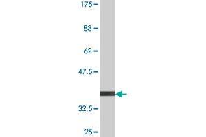 Western Blot detection against Immunogen (36. (PIK3R4 antibody  (AA 1259-1358))