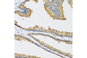 Immunohistochemistry of paraffin-embedded human prostate using CXCL11 antibody. (CXCL11 antibody)
