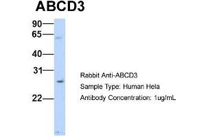 Host: Rabbit Target Name: ABCD3 Sample Type: Human Hela Antibody Dilution: 1. (CX3CL1 antibody  (N-Term))