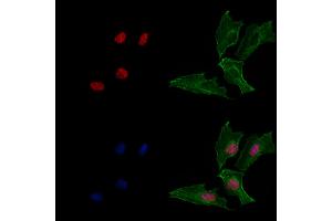 ABIN6265200 and ABIN6269069 staining  cells by IF/ICC. (SNAIL antibody  (C-Term))