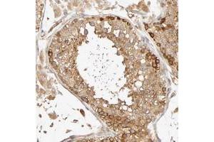 Immunohistochemical staining of human testis with SGSM1 polyclonal antibody  shows strong cytoplasmic positivity in cells in seminiferus ducts and moderate in Leydig cells at 1:10-1:20 dilution. (SGSM1 antibody)