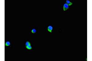 Immunofluorescent analysis of Hela cells using ABIN7171701 at dilution of 1:100 and Alexa Fluor 488-congugated AffiniPure Goat Anti-Rabbit IgG(H+L) (TTI1 antibody  (AA 692-858))