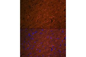 Immunofluorescence analysis of rat brain using βIII-Tubulin/β3-Tubulin Rabbit mAb (ABIN7271049) at dilution of 1:100 (40x lens). (TUBB3 antibody)