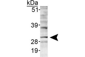 Western blot analysis of INSIG1 in HepG2 lyaste using INSIG1 polyclonal antibody . (INSIG1 antibody  (AA 1-100))