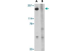 Western blot analysis of SLITRK5 in NIH/3T3 cell lysate with SLITRK5 polyclonal antibody  at 1 ug/mL in the (A) absence or (B) presence of blocking peptide. (SLITRK5 antibody  (Internal Region))