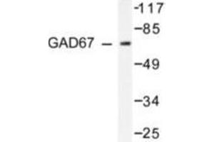 Image no. 2 for anti-Glutamate Decarboxylase 1 (Brain, 67kDa) (GAD1) antibody (ABIN265428) (GAD antibody)