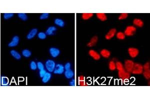 Immunofluorescence analysis of 293T cells using DiMethyl-Histone H3-K27 antibody. (Histone 3 antibody  (H3K27me))