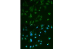 Immunofluorescence analysis of HeLa cells using ARRB1 antibody.