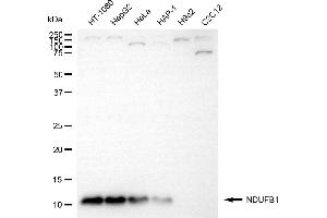 Western blotting analysis using NDUFB1 antibody (ABIN7799545).