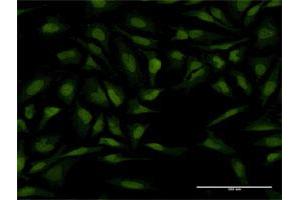 Immunofluorescence of monoclonal antibody to PTTG1 on HeLa cell. (PTTG1 antibody  (AA 93-113))