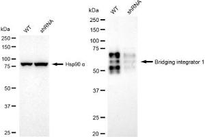 Western blotting analysis using Bridging integrator 1 antibody (ABIN7797795). (Recombinant BIN1 antibody)
