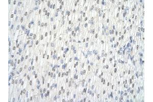 Rabbit Anti-HNRPL antibody   Paraffin Embedded Tissue: Human Heart cell Cellular Data: cardiac cell of renal tubule Antibody Concentration: 4.