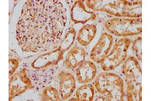 IHC image of ABIN7145242 diluted at 1:200 and staining in paraffin-embedded human kidney tissue performed on a Leica BondTM system. (BBS5 antibody  (AA 224-317))