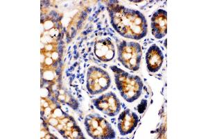 Immunohistochemistry (IHC) image for anti-Integrin alpha 1 (ITGA1) (AA 1121-1134), (C-Term) antibody (ABIN3044325)