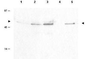 Image no. 1 for anti-Cyclin B1 (CCNB1) (pSer126) antibody (ABIN199908) (Cyclin B1 antibody  (pSer126))