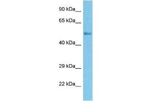 Host:  Rabbit  Target Name:  SMYD3  Sample Tissue:  Human Ovary Tumor  Antibody Dilution:  1ug/ml (SMYD3 antibody  (N-Term))