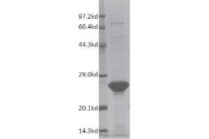 Recombinant SMARCA2 / BRM (1367-1511) protein gel. (SMARCA2 Protein (AA 1367-1511) (His tag,DYKDDDDK Tag))