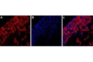 Expression of P2RX3 in rat DRG - Immunohistochemical staining of rat dorsal root ganglion (DRG) using Anti-P2X3 Receptor-ATTO Fluor-594 Antibody (ABIN7043421). (P2X3 Receptor (AA 383-397), (C-Term), (Intracellular) antibody (Atto 594))