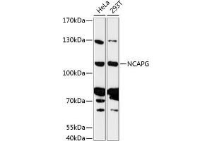 Western blot analysis of extracts of various cell lines, using NCAPG antibody (ABIN6130189, ABIN6144398, ABIN6144399 and ABIN6216998) at 1:3000 dilution. (NCAPG antibody  (AA 610-700))