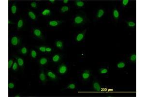 Immunofluorescence of monoclonal antibody to HNF4A on HeLa cell. (HNF4A antibody  (AA 324-423))