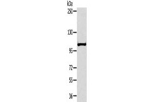 Gel: 6 % SDS-PAGE, Lysate: 40 μg, Lane: Mouse liver tissue, Primary antibody: ABIN7191695(NPR2 Antibody) at dilution 1/300, Secondary antibody: Goat anti rabbit IgG at 1/8000 dilution, Exposure time: 30 seconds (NPR2 antibody)