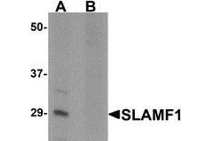 Western blot analysis of SLAMF1 in rat colon tissue lysate with SLAMF1 antibody at 1 μg/ml in (A) the absence and (B) the presence of blocking peptide