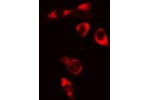 ABIN6276735 staining Hela cells by IF/ICC. (BTK antibody  (Internal Region))