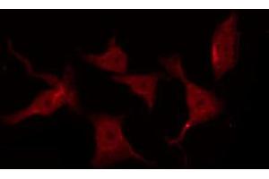 ABIN6267258 staining SK-OV3 by IF/ICC. (EGFR antibody  (pThr678))
