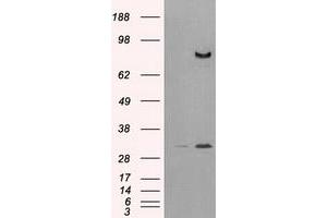 HEK293T cells were transfected with the pCMV6-ENTRY control (Left lane) or pCMV6-ENTRY DPP4 (Right lane) cDNA for 48 hrs and lysed. (DPP4 antibody)