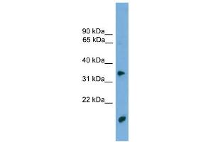 WB Suggested Anti-TMPRSS3 Antibody Titration: 0. (TMPRSS3 antibody  (N-Term))